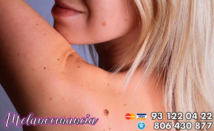 melanomancia